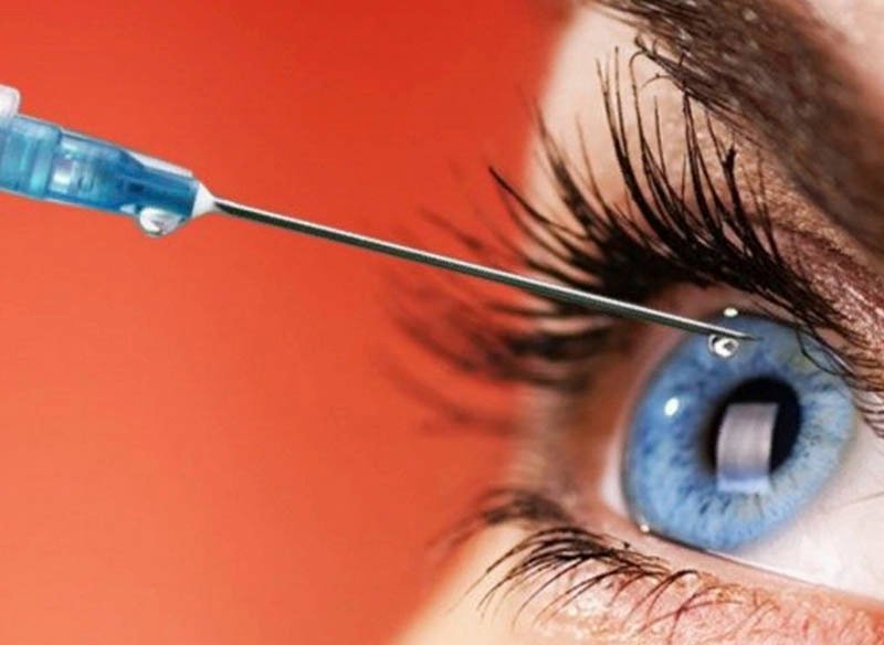 Інтравітреальна ін’єкційна терапія - Закарпатський центр зору та Закарпатський центр мікрохірургії ока