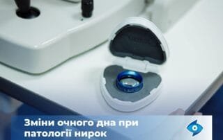 Які зміни у структурі очного дна викликають патології нирок? - Закарпатський центр зору та Закарпатський центр мікрохірургії ока