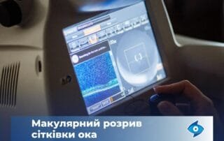 Деформація контурів предметів — ознака макулярного розриву сітківки - Закарпатський центр зору та Закарпатський центр мікрохірургії ока