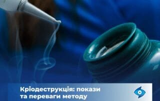Лікування холодом, або Що таке кріодеструкція? - Закарпатський центр зору та Закарпатський центр мікрохірургії ока