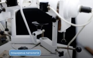 Які методи ми застосовуємо для лікування косоокості? - Закарпатський центр зору та Закарпатський центр мікрохірургії ока
